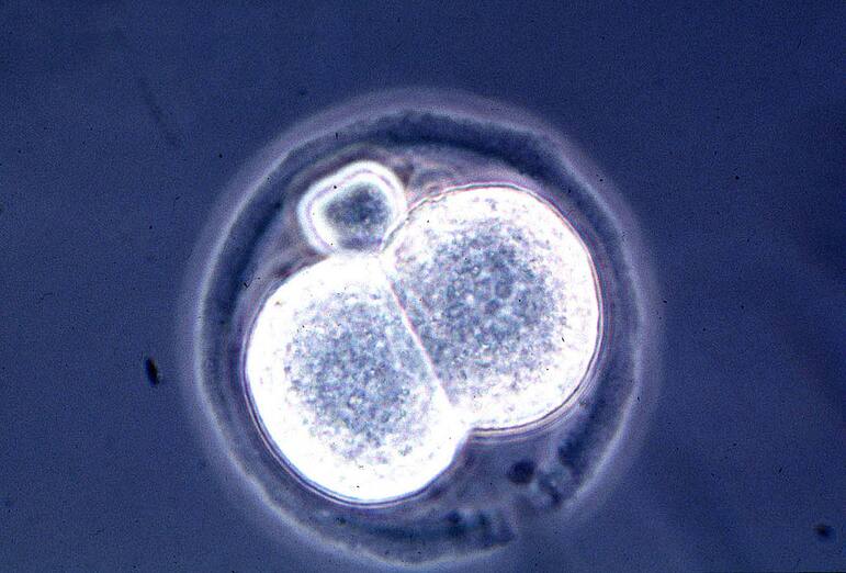 Microscopic View Of A Two Cell Mouse Embryo, A Result Of A New And Relatively Simple Cloning Technique Discovered By Scientists At The University Of Hawaii July 1998. The Scientists Have Created Dozens Of Cloned Mice, Marking The First Documented Cloning Of Adult Mammals Since Researchers In Scotland Announced The Birth Of Dolly The Sheep Last Year. (Photo By Getty Images)