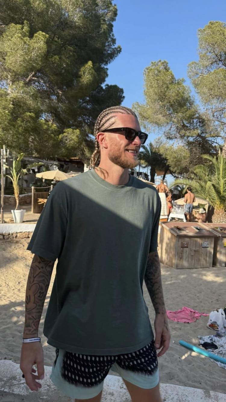 Loris Karius con le treccine