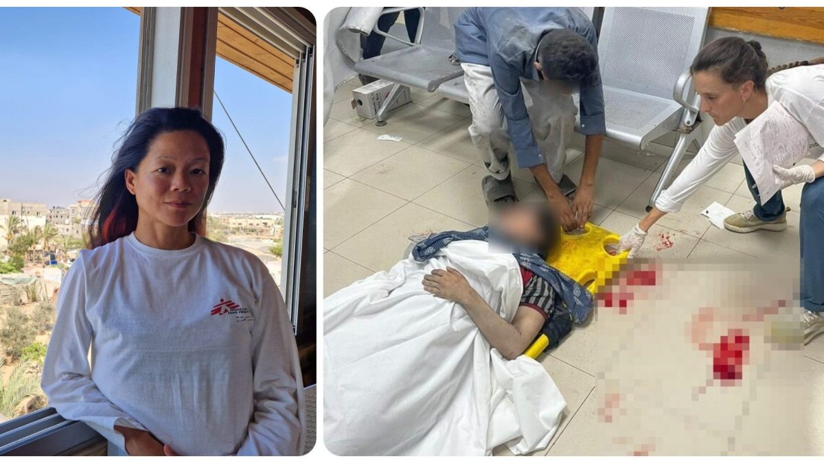 La dottoressa Amy Kit-Mei Low (a sinistra) e una sua collega di MSF alle prese con un ferito all'ospedale Nasser