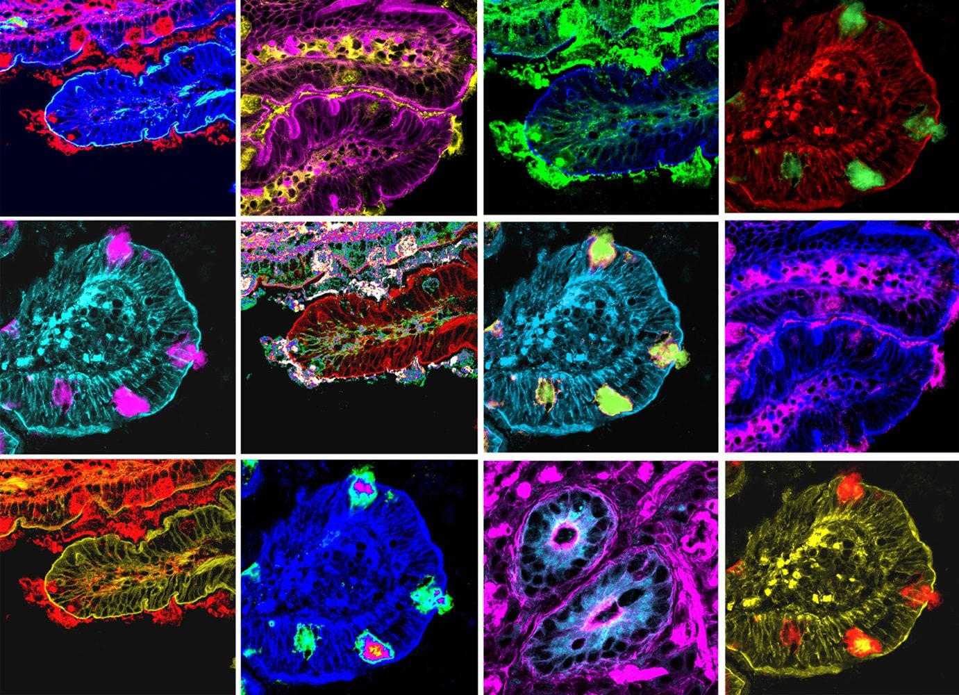 MICROBIOTA Intestinale