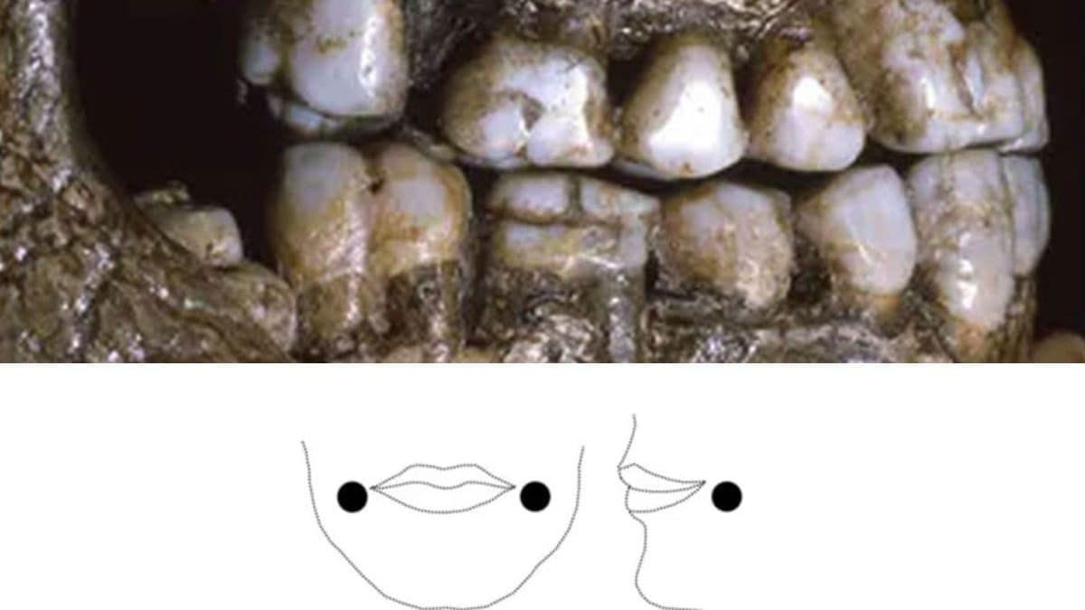 I segni di usura osservati sui denti suggeriscono l’uso di piercing alle guance già dall’infanzia / Credit John Willman