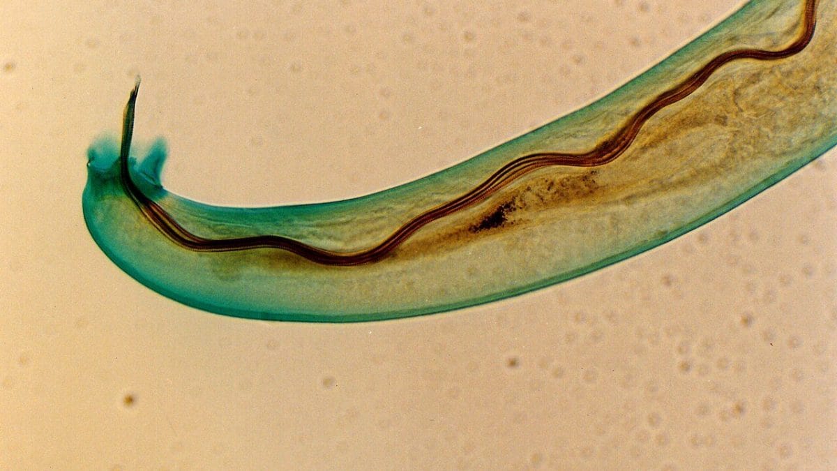 Il verme nematode Angiostrongylus cantonensis responsabile dell'infezione. Credit: Wikipedia